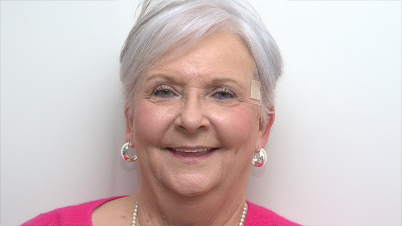 Harmony Oral   Facial Surgery | Ridge Augmentation, Sedation and General Anesthesia