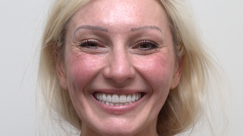 Harmony Oral   Facial Surgery | IV Sedation, Microneedling and Fillers