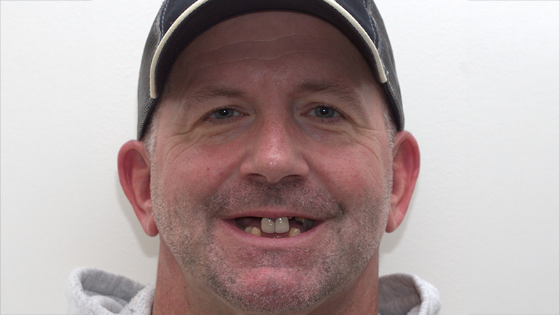 Harmony Oral   Facial Surgery | Teeth in a Day, Nitrous Sedation and Oral Pathology